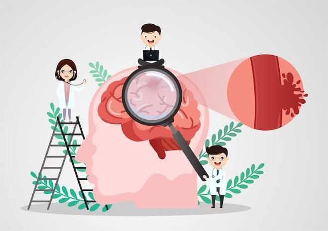 Mengenal Tes MCMI: Tujuan, Aspek yang Diukur, dan Manfaatnya
